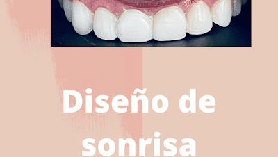 Anydent Cuidando tu sonrisa