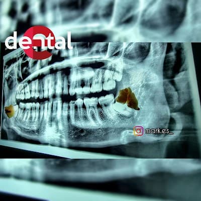 Edental
