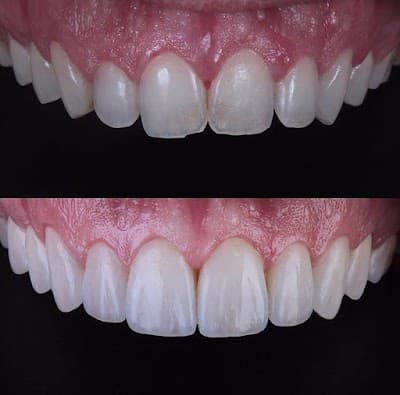 BAZA Clínica Dental Integral; llamadas y mensajes por whatsapp las 24 horas; Todos los especialistas en un solo lugar