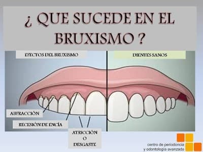 Centro De Periodoncia Y Odontología Avanzada