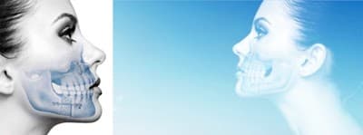 Cirugía maxilofacial Dra. Astrid Judith López Orozco