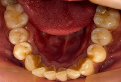 Cirujano Dentista De La Rosa