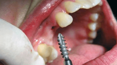 Clínica Dental Funnydent ( Dentistas en Matamoros )