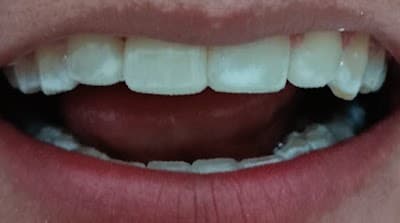 Clinica Dental Hacienda Real