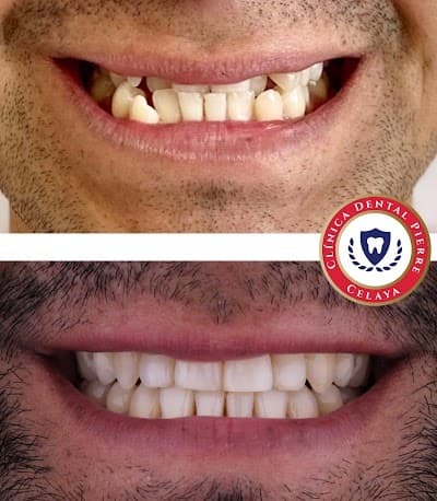 Clínica Dental Pierre Celaya