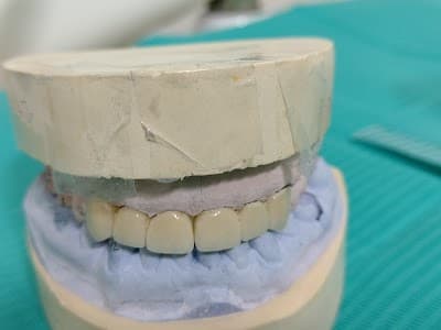 Consultorio Dental Dr. Angel Cattaneo Cramer