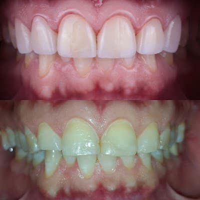 Consultorio Dental Humaya En Culiacan, Dentista Dr. Yusseff O. Rivera