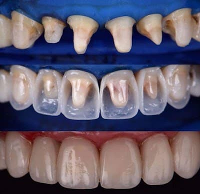 Dental Care "Agrícola Oriental"