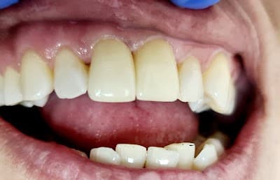 DentAll donde tu sonrisa es una realidad