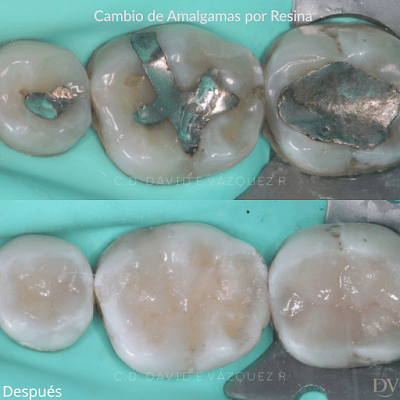 Dentista David Vázquez | Consultorio Dental