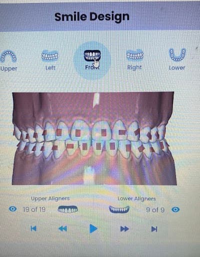 Dentista Dentactic | Coapa