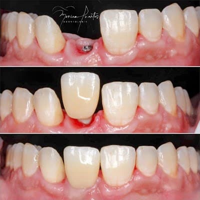 Dentista Dra. Mónica Fuentes