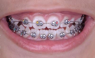 Dentista en Azcapotzalco