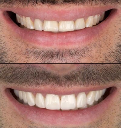 Dentista en Cdmx. Dr Yamil Romero