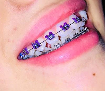 Dentista | Especialista en Ortodoncia y Carillas CDMX |