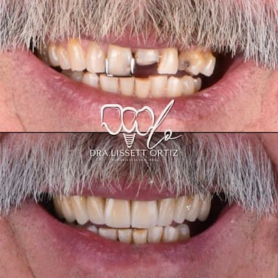Dentista Especialista en Rehabilitación oral Dra. Lissett Ortiz