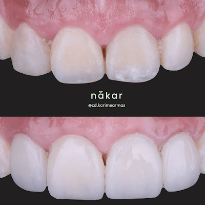 Dentista Jardines del Pedregal Dra. Karime Armas