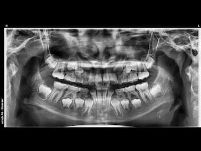 Dentista Odontología Familiar y Estética Campeche