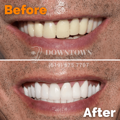 Downtown Dental Clinic