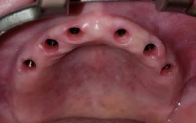 Dr. Alfonso Gonzalez Ocaranza, Dentista - Odontólogo