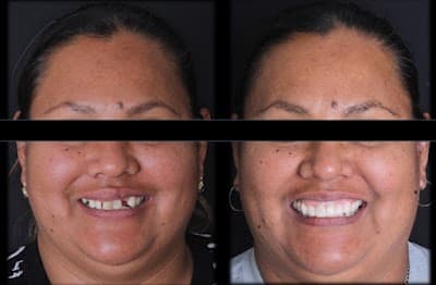 Dr. Saul Pulido Dentista