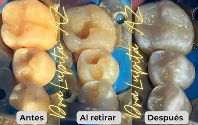 Dra. Dentista Guadalupe Alvarez Zaragoza