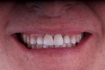 Dra. Hatsuko Yalí, Dentista - Odontólogo