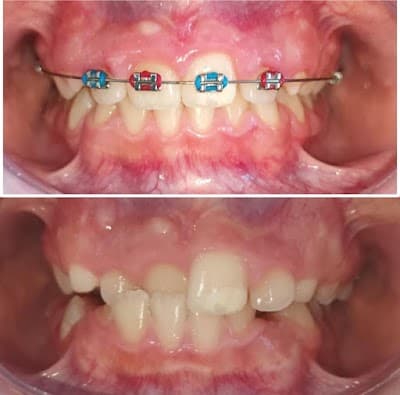 Dra. Nayeli Herrera. Dentista en Morelia