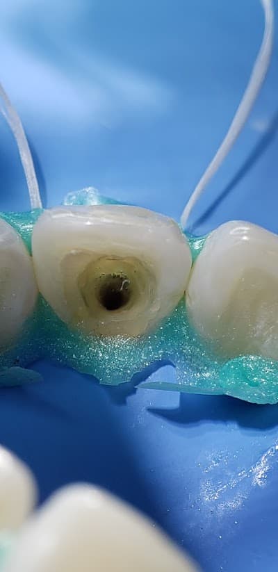 ENDODONCIA CONDESA