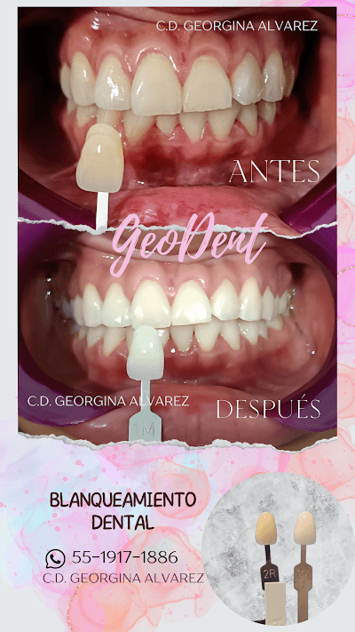 GEODENT C.D.Georgina Alvarez| Dentista, Odontología Estética, Cirugía Maxilofacial, Ortodoncia, Odontopediatra.