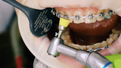 INTEGRALIS • Mi Dentista Puebla •