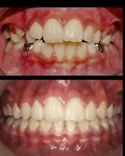 LUX Dental Studio TECAMACHALCO