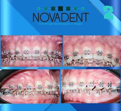 NOVADENT/DENTISTA. Suc. Chetumal