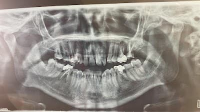 Ocean Smile Consultorio dental