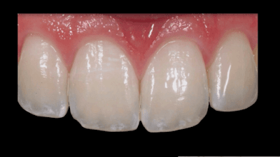 Odontología Estética e Implantología