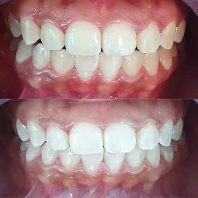 Pantoja Dental Clinic