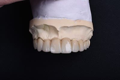 SMILE IMPLANT CENTER NAPOLES