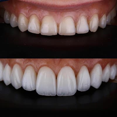 Smile Vallarta Dentist