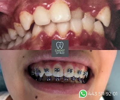 Sweet Smile Clinica Dental