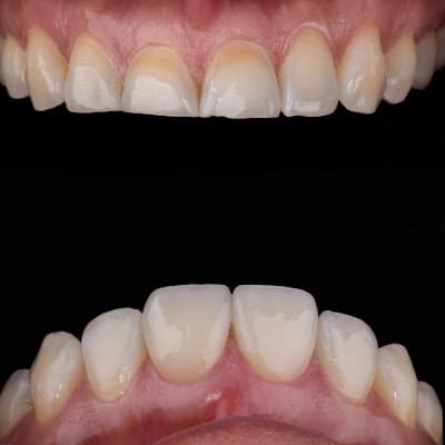 Tooth Core, Odontología restauradora y Ortodoncia.