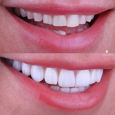 Alamo Dental Studio CDMX