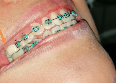 Centro de Atención Dental Integral