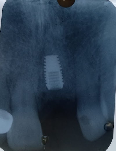 CLINICA DENTAL DEntAle.