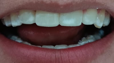 Clinica Dental Hacienda Real