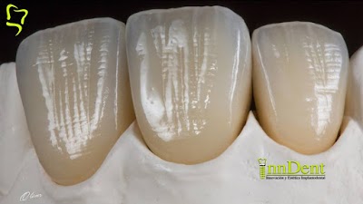 Clínica Dental InnDent