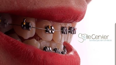 Clinica dental smile center Gdl