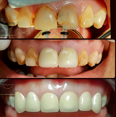 Consultorio Dental Acapulco dr Saudi