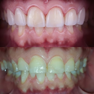 Consultorio Dental Humaya En Culiacan, Dentista Dr. Yusseff O. Rivera