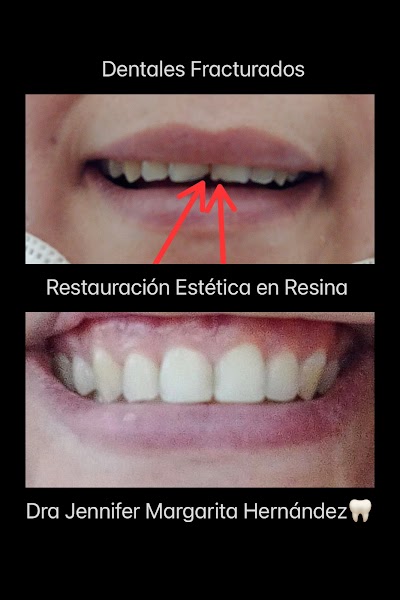 Consultorio Dental Jennifer Hernandez Dentista