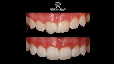 Dental Díaz Estética Dental - Dentista (Rehabilitación, Ortodoncia, Endodoncia, Periodoncia, Implantología)
